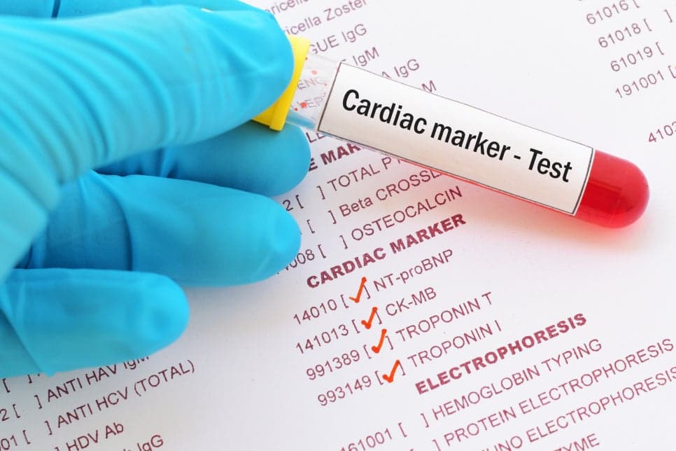Troponin I 검사, 어떤 쓸모가 있을까요?